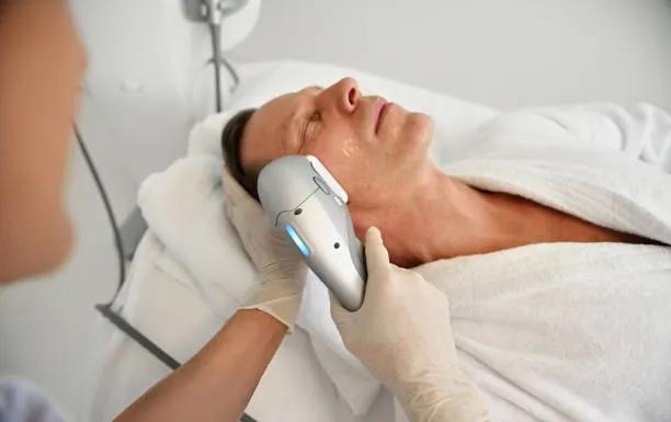 What Morpheus8 Treatment In San Jose Actually Does To Your Skin